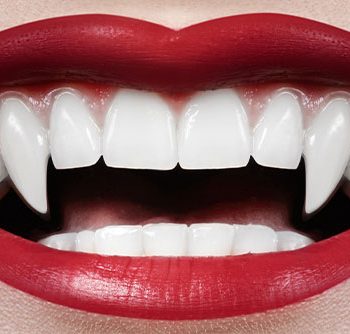 Gefährlicher Halloween-Trend: Vampirzähne dank Nagelkleber